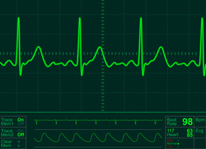 ECG (Elettrocardiogramma) Torino